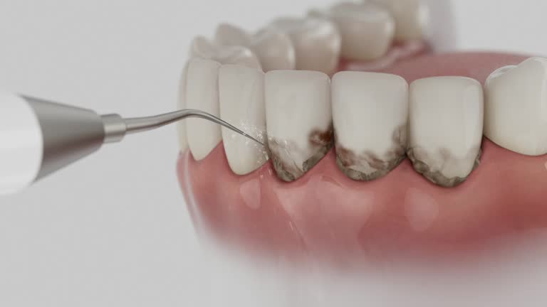 Reliable Dental Implants contractor in Massac, KY by Smile Center Dentistry